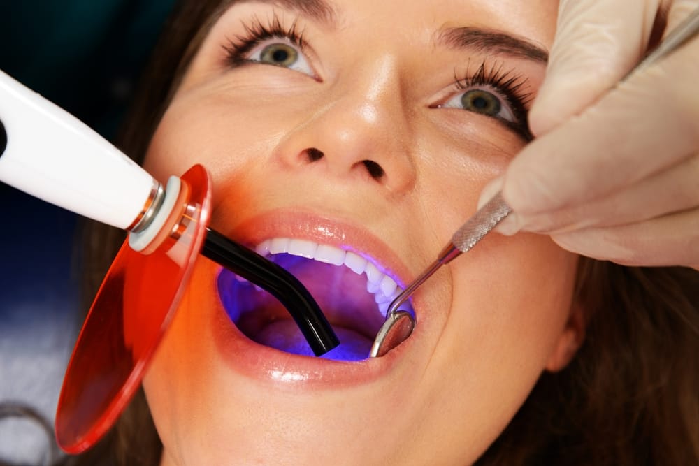 A dental patient undergoing a curing light treatment with a protective orange shield, while a dental tool is used by the dentist - dentist Cupertino